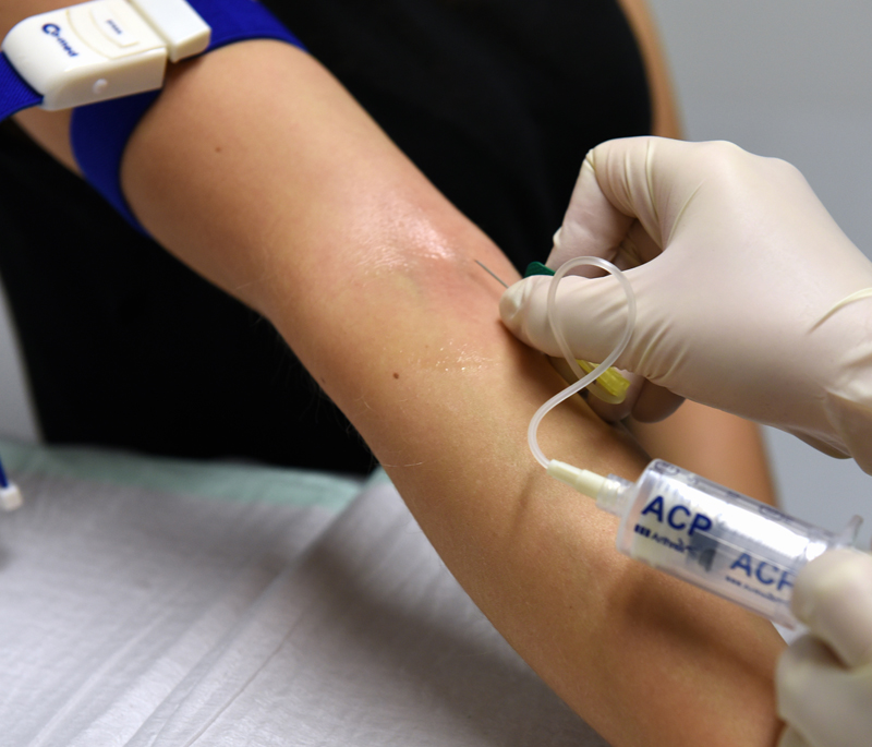 Blutentnahme | Dr. med. Michael Nager im Orthopädiezentrum München City